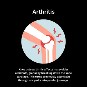 Illustration shows arthritis as a major cause of chronic knee pain in older adults