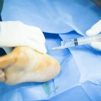 Medical professional performs foot injection during surgery, illustrating ankle replacement vs fusion treatment process
