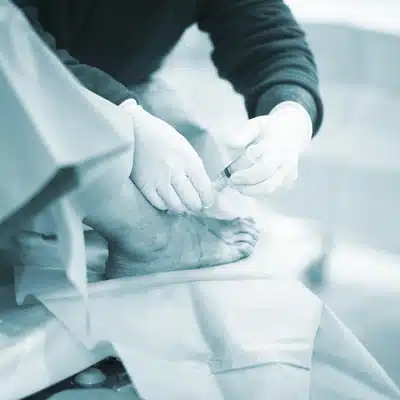 Surgeon administers injection to patient’s foot during procedure, with sterile drapes covering surrounding treatment area.