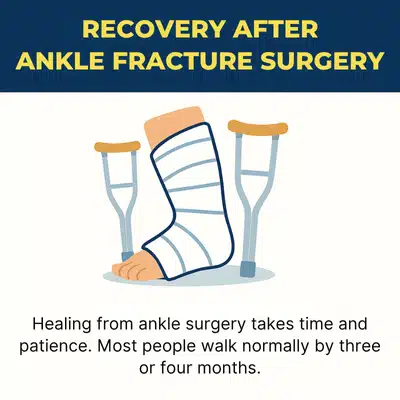 Illustrated graphic explaining healing process after ankle fracture surgery, showing bandaged foot and crutches