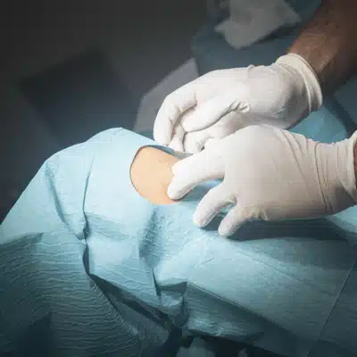 Surgeon prepares patient’s knee area before performing a total joint replacement procedure in hospital