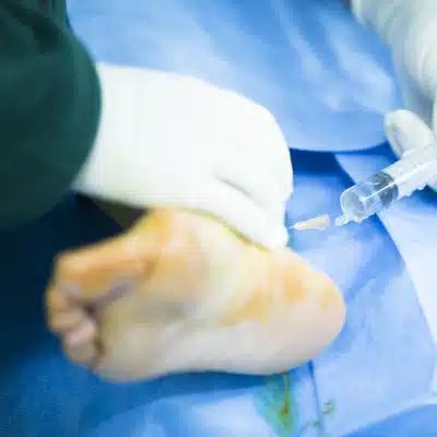 Medical professional injects medication into a patient’s foot during a delicate ankle surgical procedure