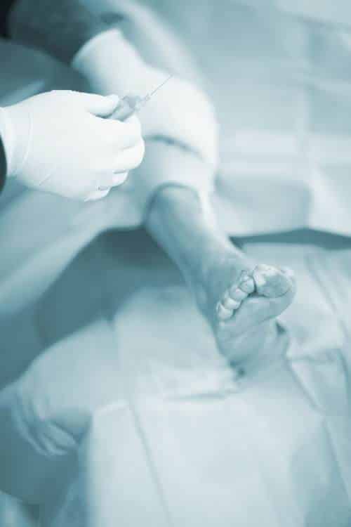 Surgeon preparing an injection during an ankle procedure